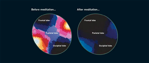 brain before and after meditation